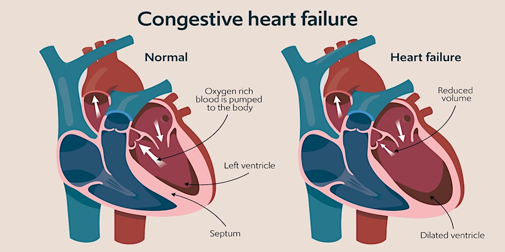 When to Refer to Cardiology